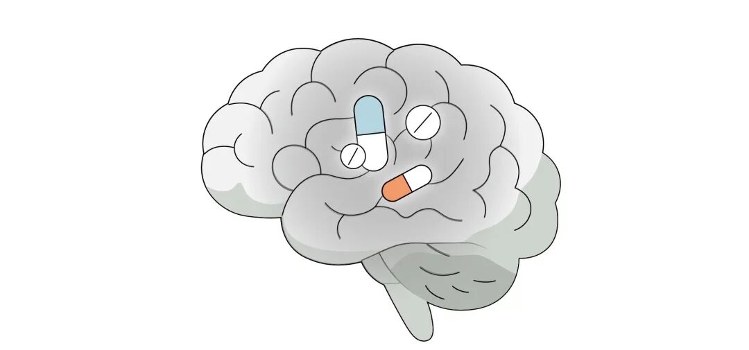Illustration of DBS brain–computer interface care