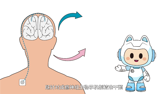 Animated DBS technology illustration