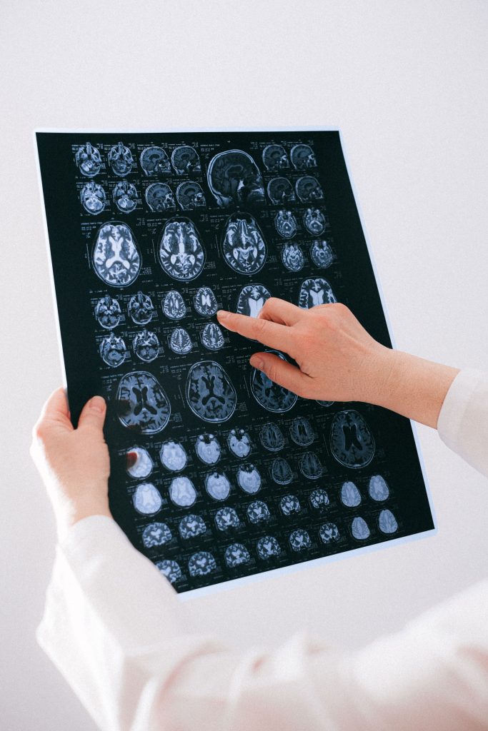 Clinician reviewing a brain scan for neuroscience care