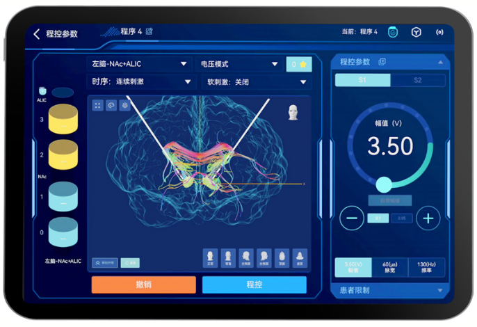 Professional DBS clinical reference illustration