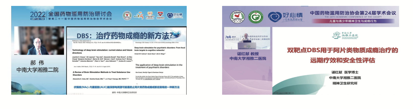 Professional DBS clinical reference illustration