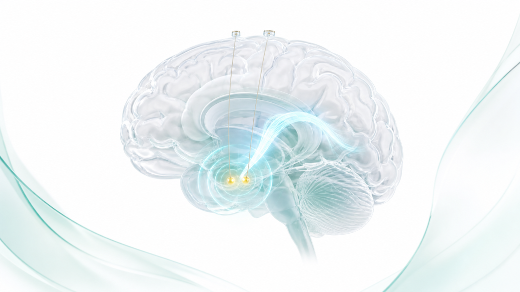Clinical brain anatomy illustration for deep brain stimulation education